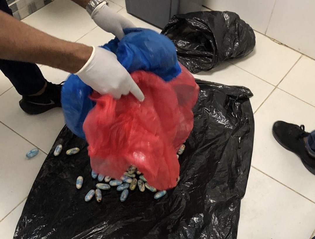 ATRAPAN PORTUGUES EN AIPC CON 76 CÁPSULAS EN EL ESTOMAGO PRESUMIBLEMENTE COCAÍNA