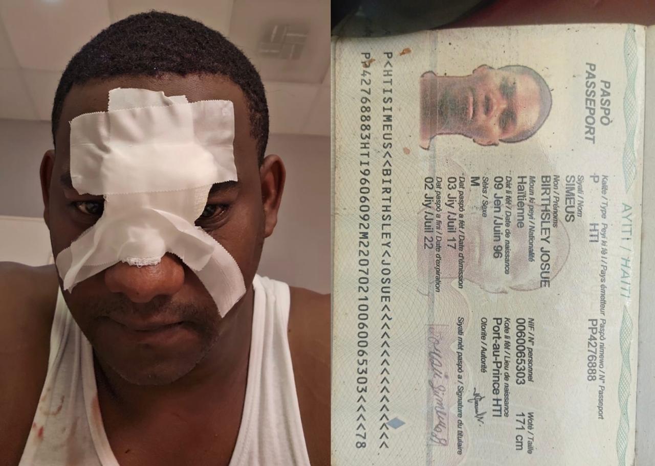 Haitiano irregular agrede a chofer de Migración en Higüey